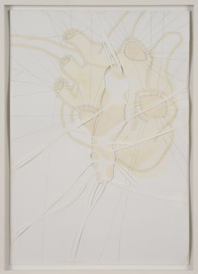 Án titils -hjartaþræðing